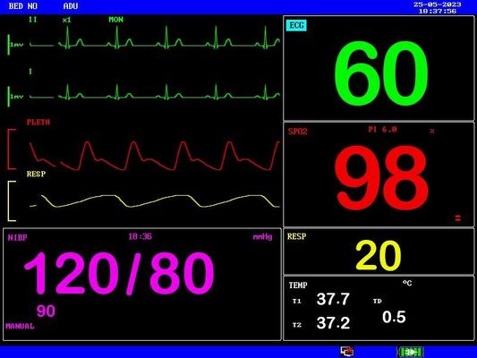 Batería recargable Monitor portátil para pacientes Compacto y ligero