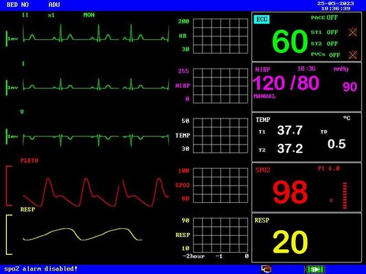Batería recargable Monitor portátil para pacientes Compacto y ligero